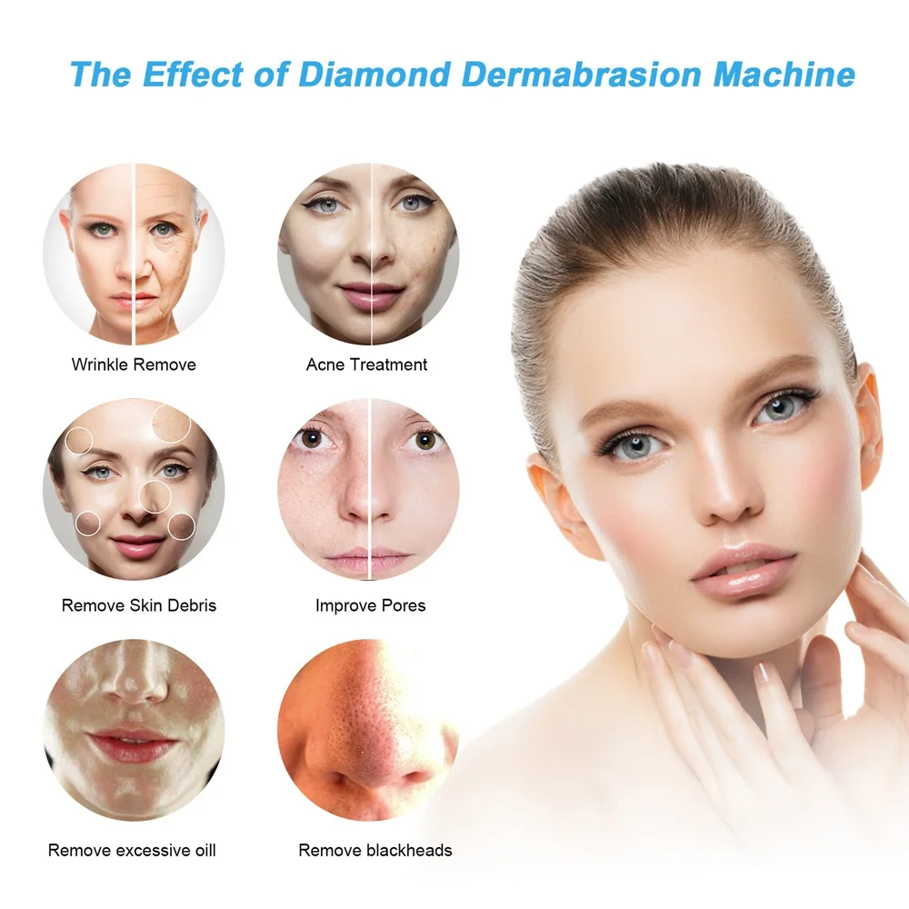 Micro dermabrasion เครื่องขัดถูเปลือกเพชร Blackhead Remover