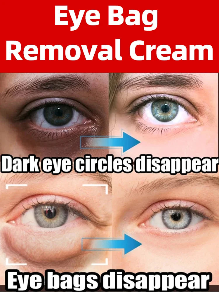 7 Day Eye Bags Cream Bag Fade Eyes Fine Line