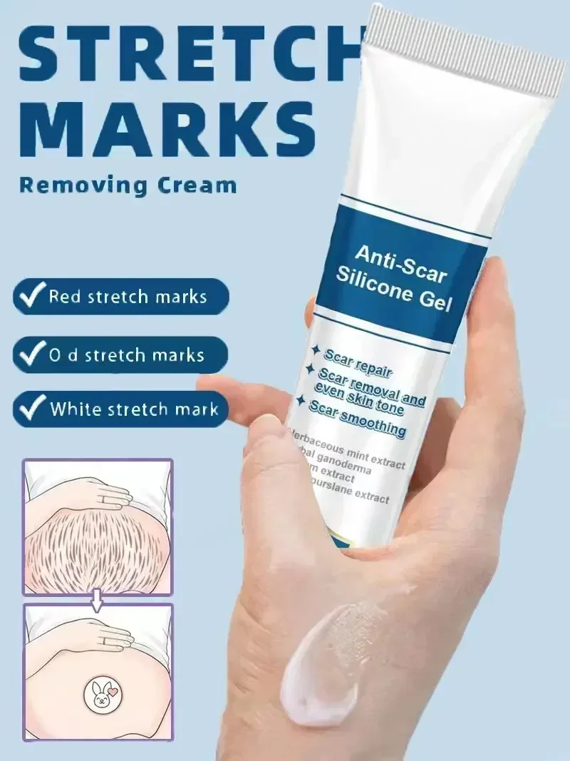 Krim penghilang Stretch mark merah putih, Gel perawatan kulit anti melahirkan