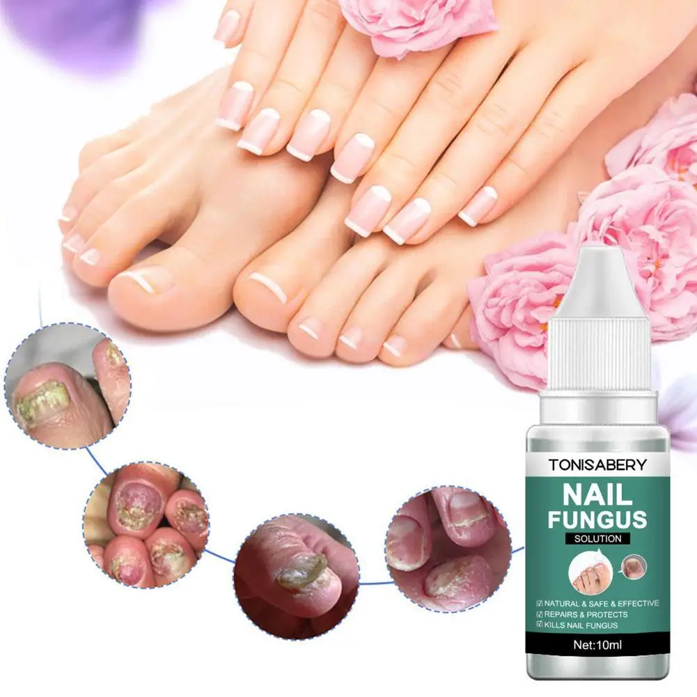 10ml Nagel pilz Reparatur Lotion Füße Pflege Essenz Anti-Entfernung Onycho mykose Infektion Paronychie Gel Pilz Zehen nagel x7q2