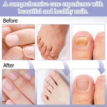 8 最佳銷售 菌 - №5