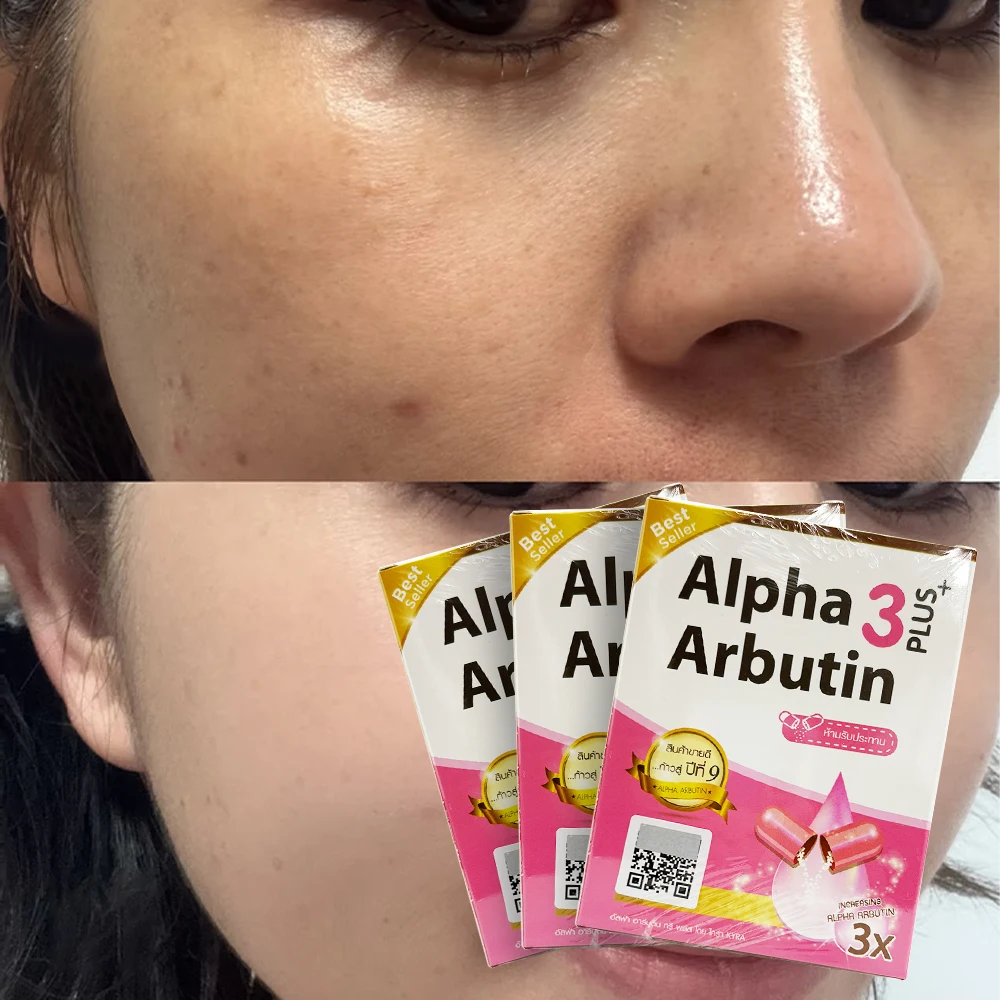 3 cajas de mezcla de polvos Alpha Arbutin 3 Plus con loción para aclarar la piel, iluminar y reducir las imperfecciones de la piel oscura