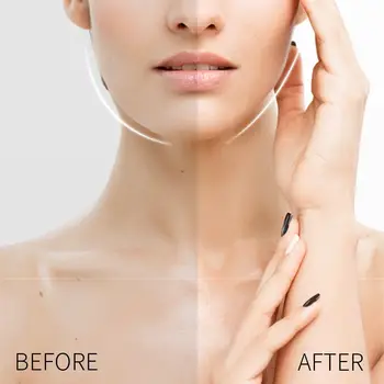 10 best sales 눈 리프팅 - №7