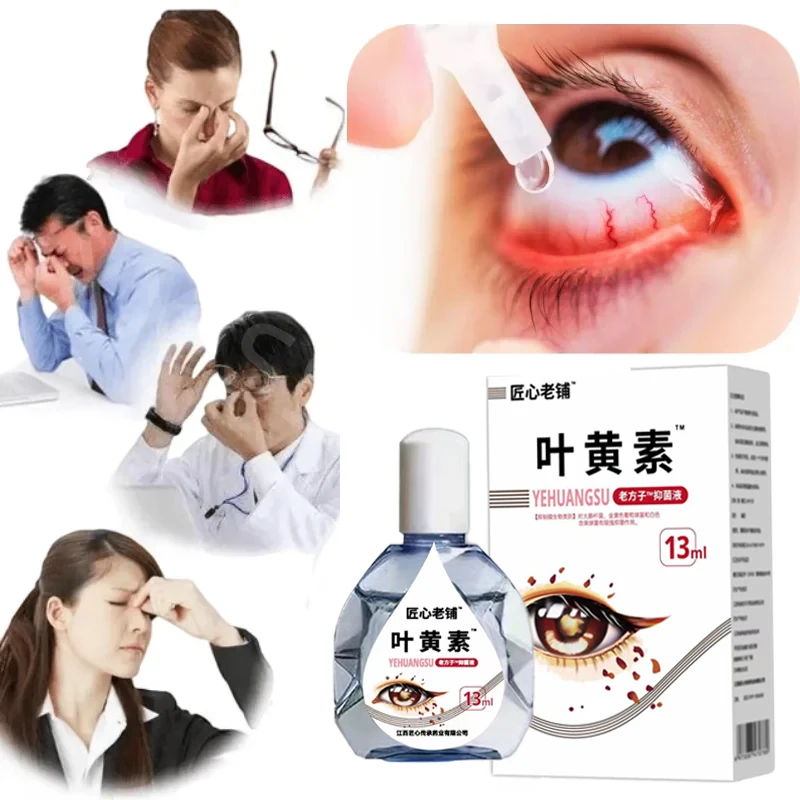 1/2PCS Lutein Eye Drops Relieve Eye Fatigue and Dryness Improve Vision Eye Care for Shadow Cloudy Blurred Vision Drops B6,E