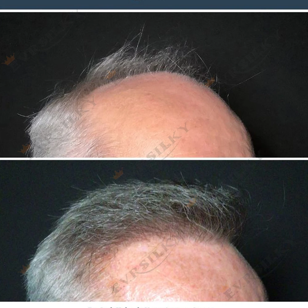 

Супертонкая кожа серого цвета 1B80 550р. # Мужской парик 0,02 мм, натуральная линия волос, незаметная, плотность 80%, мужской капиллярный протез, парик, система