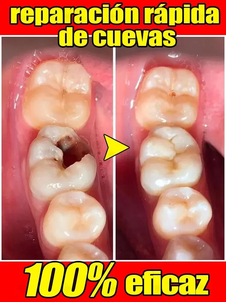 

Anti-caries toothpaste whitens teeth