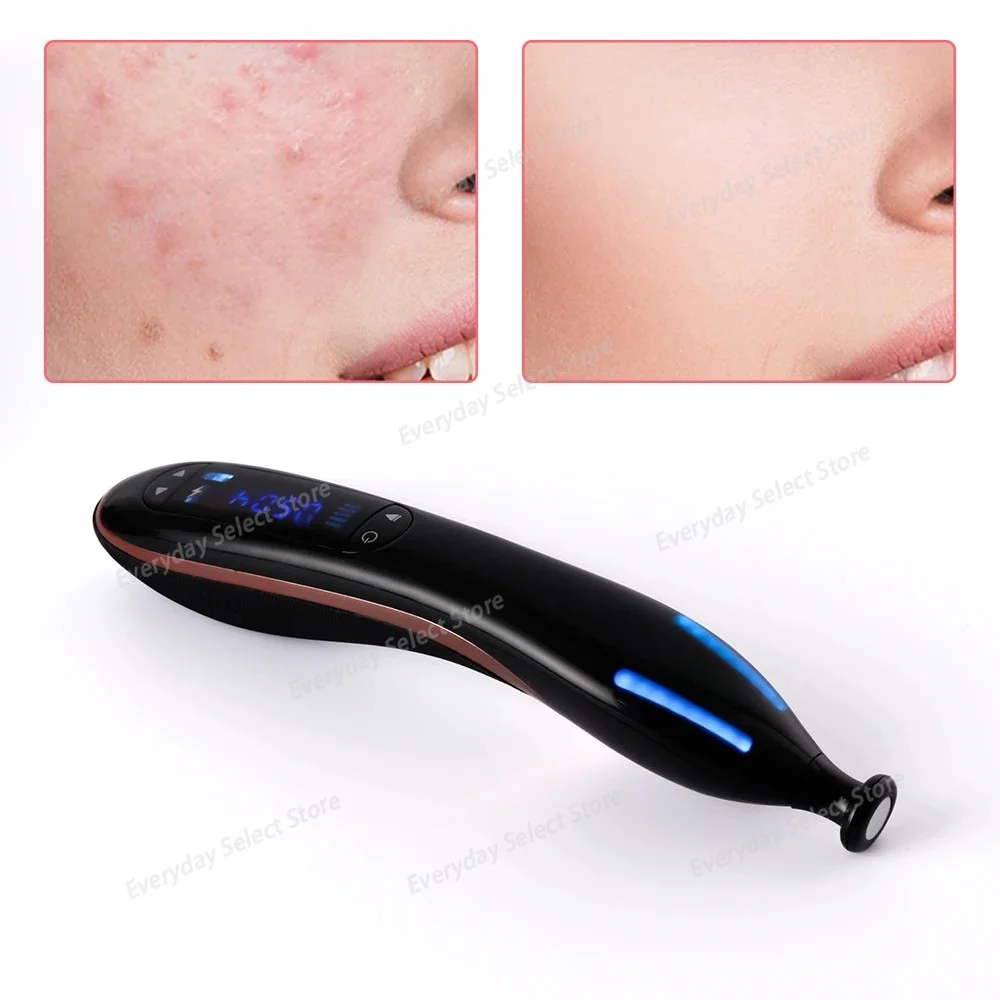 Plasma Non‑contact Acne Beauty Device, Household High Frequency Electrotherapy Facial Ozone plasma beauty Instrument