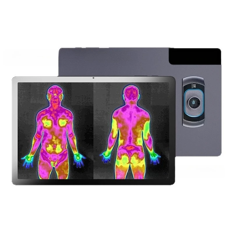 Thermal Imager Acupuncture and Moxibustion Traditional Chinese Medicine Museum Health Detector