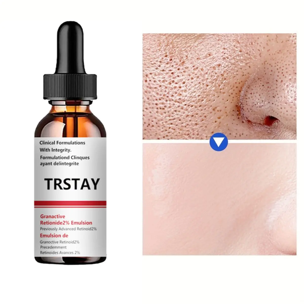 5ML/15ML/30ML/50ML/Pore Minimizer Serum For Face Facial Pore Narrowing Serum Pore Contraction Tightens Essence Shrink Pores Tigh