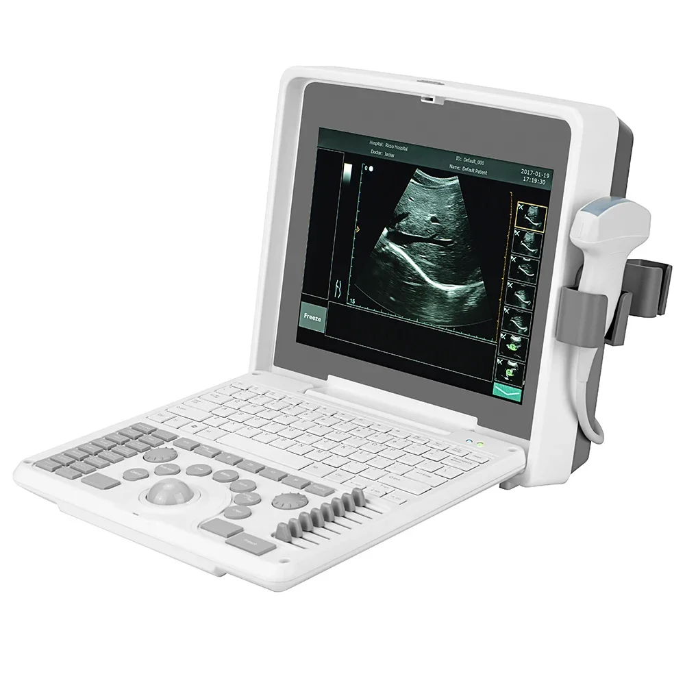 

And White Echocardiography Multiprobe Medical Instruments Sonography Human Ultrasound Machine Portable Cheapest Black Electric