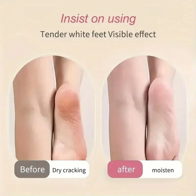 1Pair Silicone Long Moisturizing Socks Anti Cracking Foot Protection Socks Soft Foot Exfoliating Stockings Comfortable Foot Care
