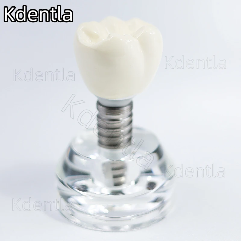 Dental Implant Model Teeth Teaching Crystal Crown Demonstration Removable Dentures Analysis Study Clear