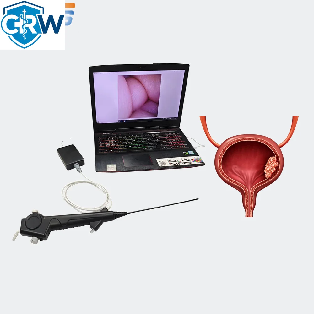 CRW USB HD Cystoscope Flexible   Digital   Urology Videoscope Factory Price Cystoscope for Vet