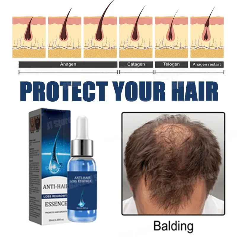 Hair Loss Treatment Spray Nourishing Regrowth Root Thicken Anti Fall Prevent Baldness Repair Damage Grow Hair Essence Spray