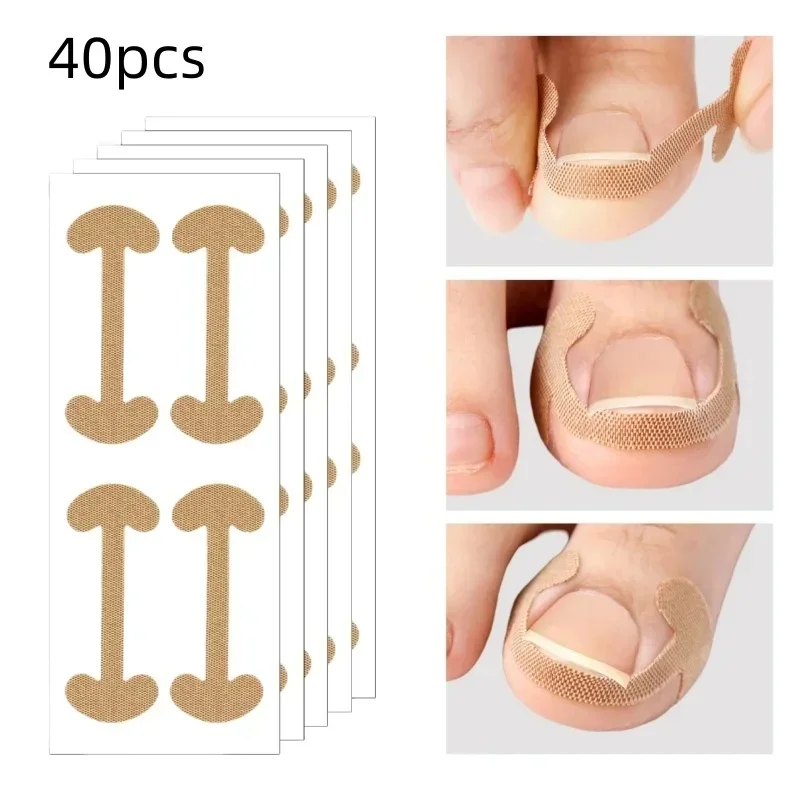 5-30sheet Ingrown Toenail Correction Tape, Long-lasting Adhesion, Nail Correction Tape, Foot Care and Pedicure Tools