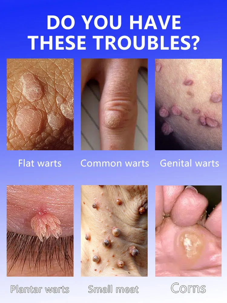 Migliora prima della fine luglio. Idratare e idratare la pelle.