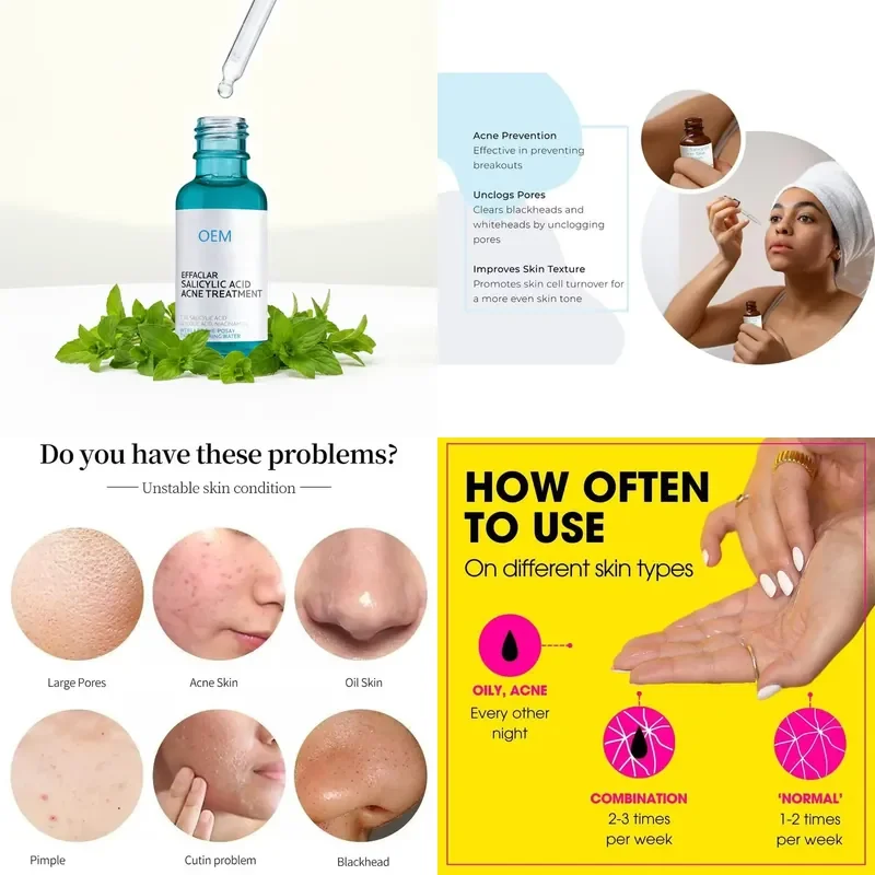 

【CHIMU HOME】 Effaclar Salicylic Acid Acne Treatment 1.5% SA Serum with Niacinamide for Blemish Prone for Acne
