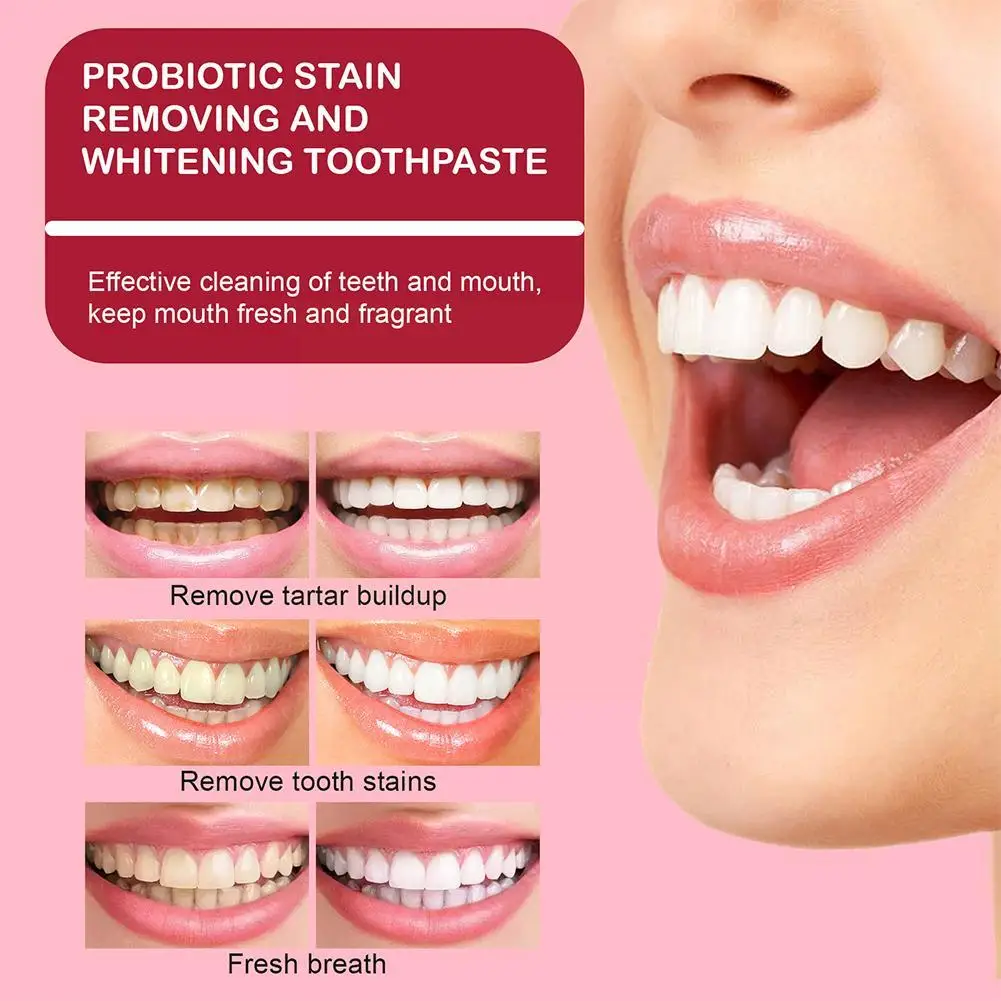 30ml Probiotic Brightening Toothpaste Oral Care Breath Oral Toothpaste Cleaning Fresh Prevents Plaque E7B3