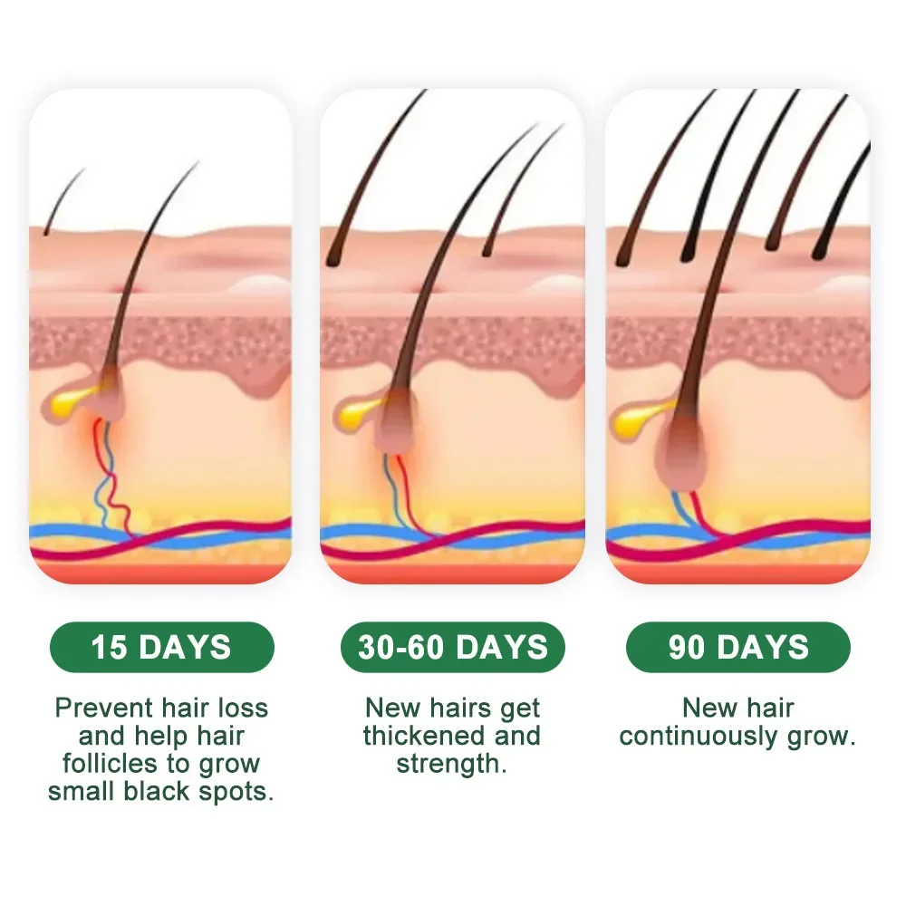 Крем для быстрого роста волос с имбирем, против выпадения волос, облысения, восстановление поврежденной кожи головы, питание, средства по уходу за корнем волос для женщин и мужчин