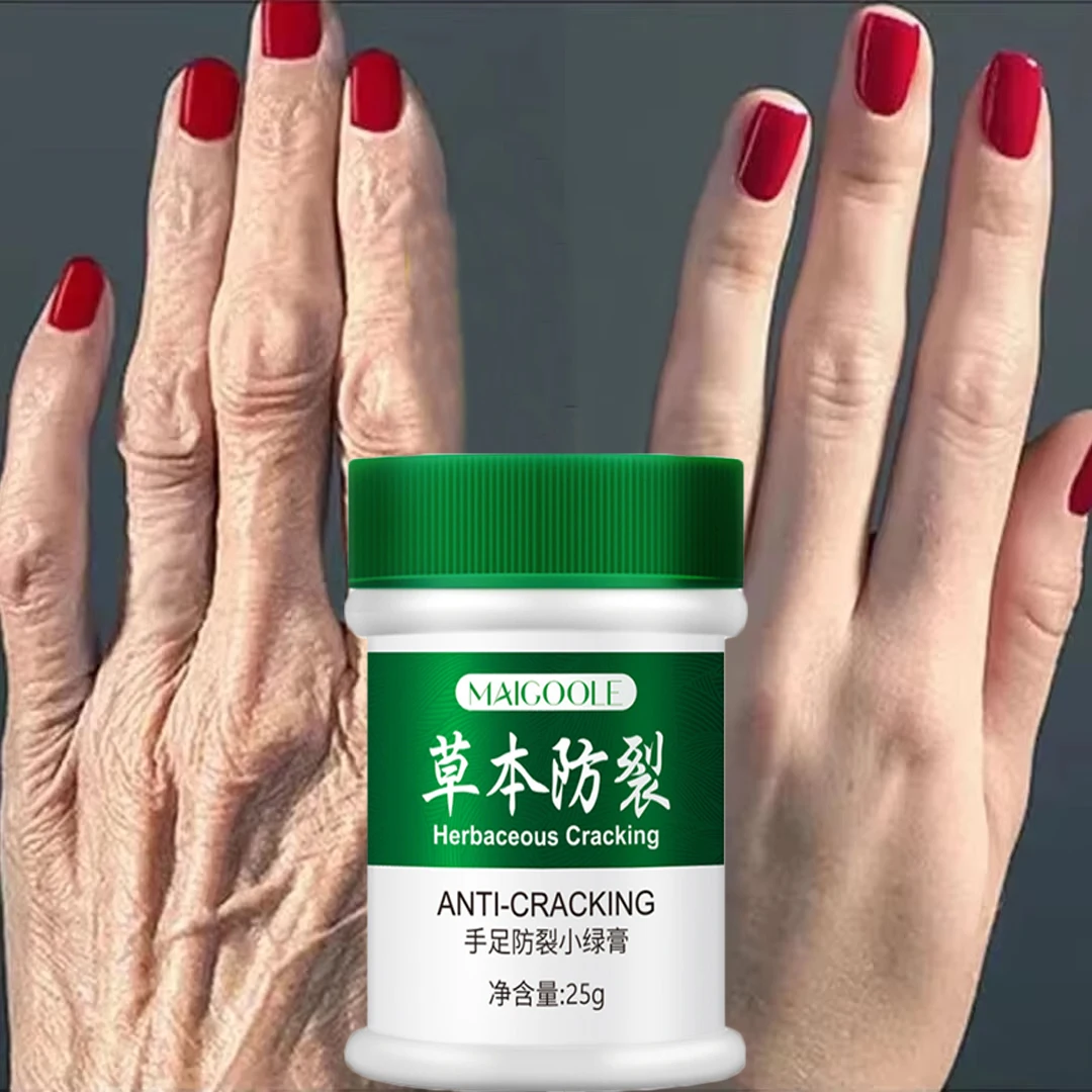 Hand Foot Anti-Cracking Herbal Cream Improve Dry Dry Body Smooth Nourish Cream Exfoliation Dead Skin Heel Cracked Moisturizer