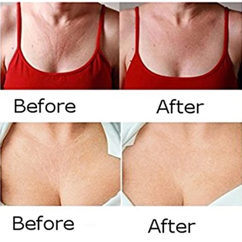 Reusable Silicone Neck Pad Neck Wrinkle Treatment Prevention Anti Wrinkle Anti-Aging Wrinkle Chest Pad Smoothing Wrinkle Patch