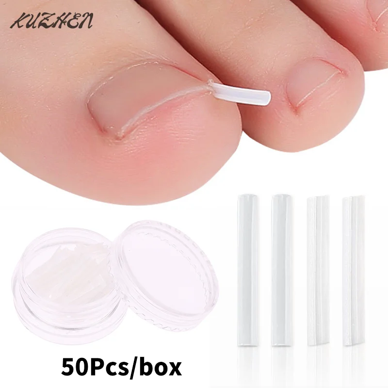 50Pcs Ingrown Toenail Correction Tool Ingrown Toe Nail Treatment Elastic Patch Sticker Straightening Clip Brace Pedicure Tool