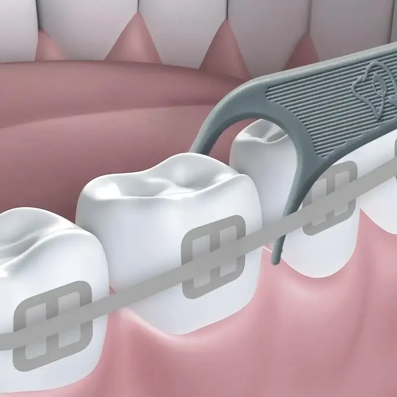 60 Stuks Orthodontische Flossers Voor Bretels Ortho Dental Floss Picks Tandenstoker Floss Interdentale Tanden Cleaner Voor Volwassenen & Kinderen