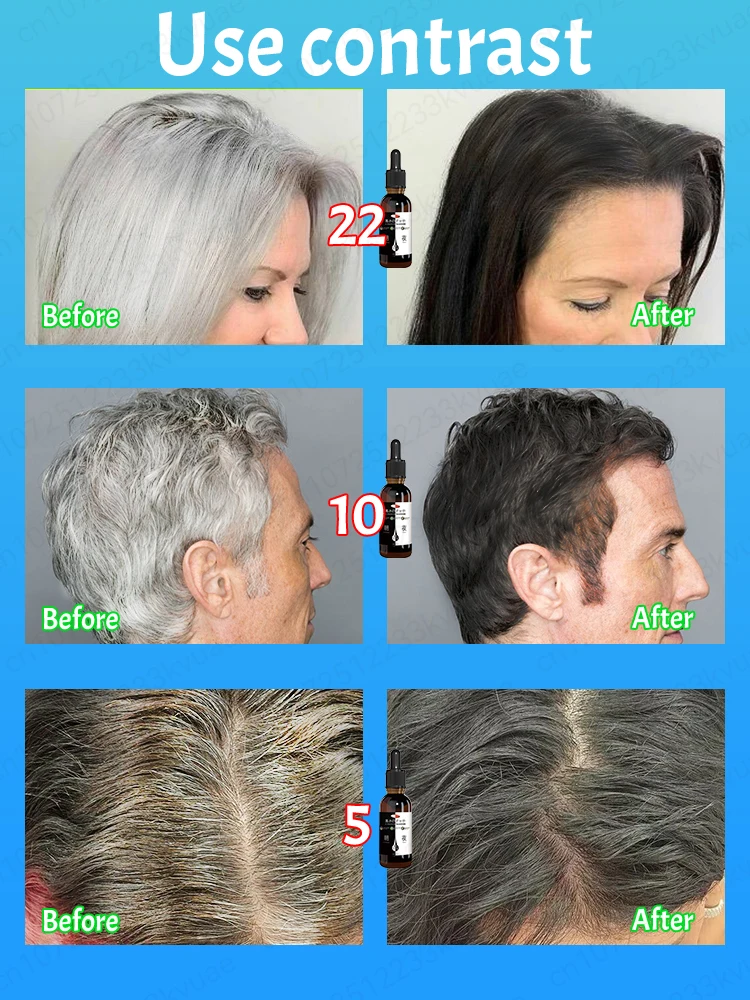 Laissez du noir grandir fort, le blanc estompe lentement