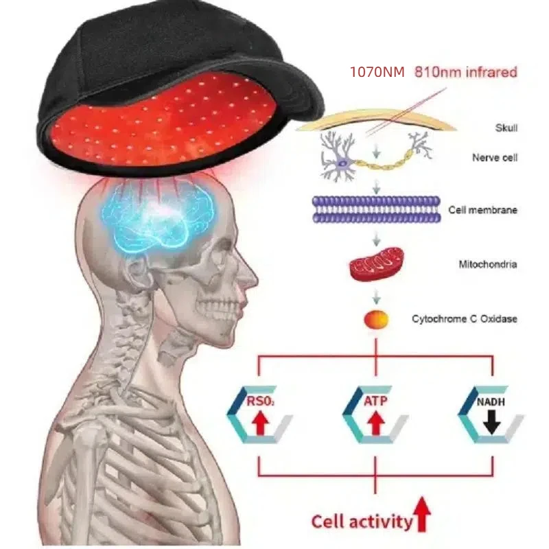 

Терапия красным светом 1070 нм для лечения болезни Паркинсона, светодиодный шлем для фотобиомодуляции ближним инфракрасным светом (PBM) при инсульте, депрессии, болезни Альцгеймера