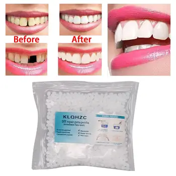 Kit de reparo temporário de dente 25g, contas térmicas, enchimento, correção de folheados de dente quebrado falsificados, cuidados bucais falsos moldáveis