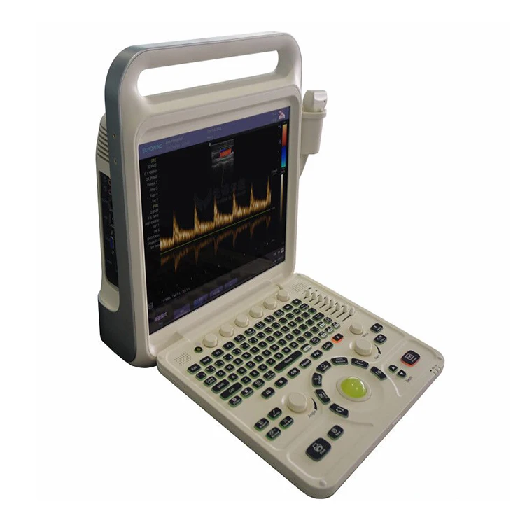 Wholesale E60 Full Digital Color Doppler System Suppliers Therapeutic Portable Ultrasound Equipment