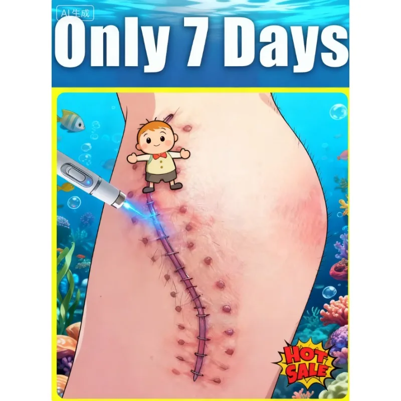 

Модернизированный шрам первого поколения восстановление корней шрамов uickly