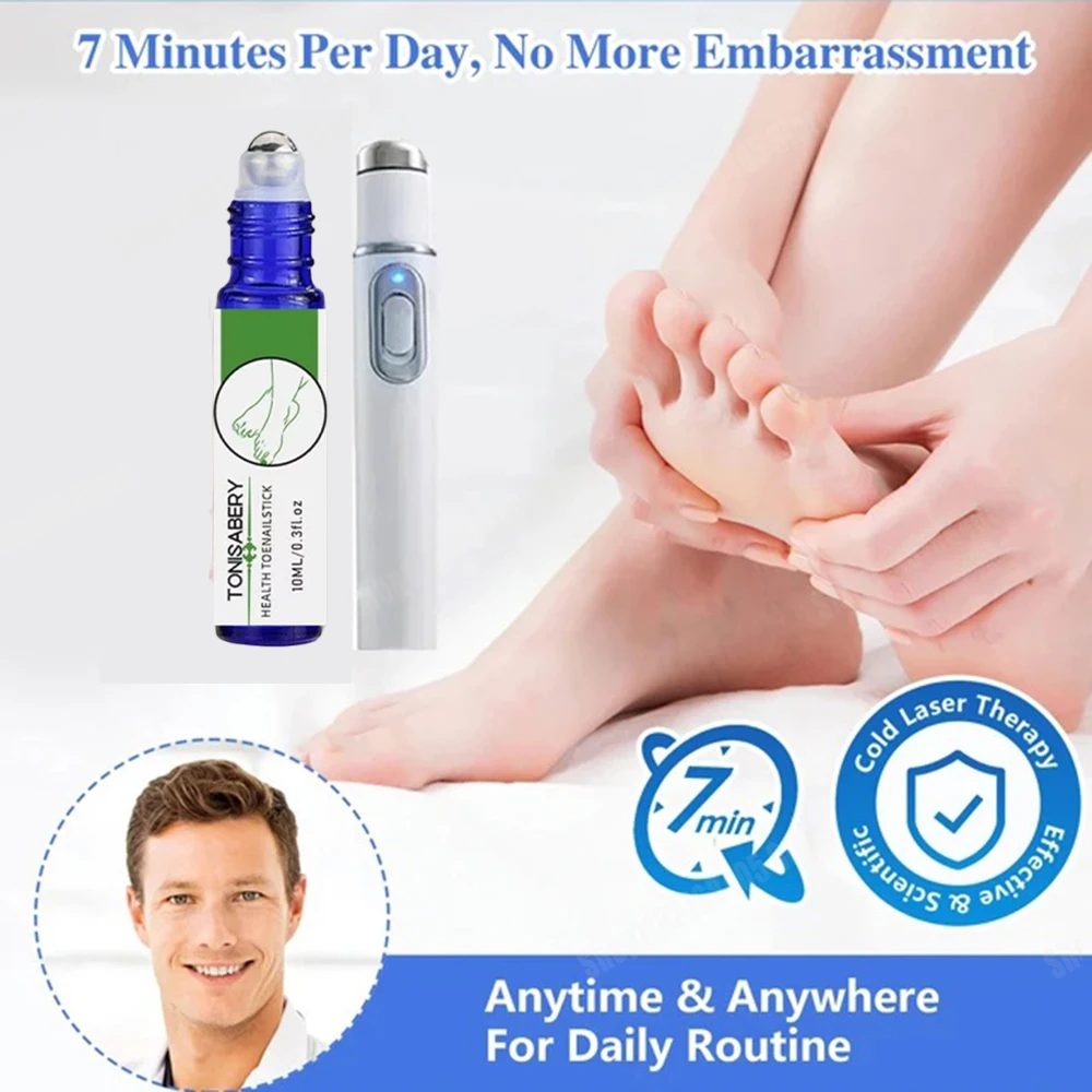 爪真菌レーザーペン 爪真菌クリーニングレーザー装置 爪真菌レーザー治療 損傷した変色した厚い足の爪