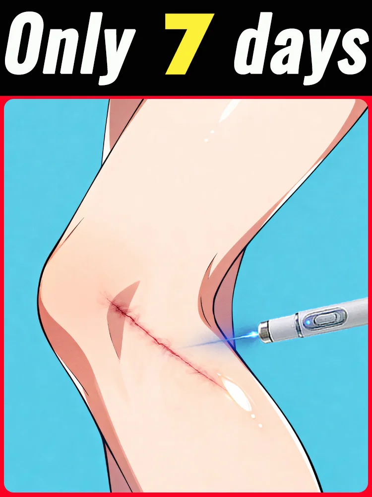 

Ручка с синим светом. Нет матки, как длинный шрам, это, может быть растворен.