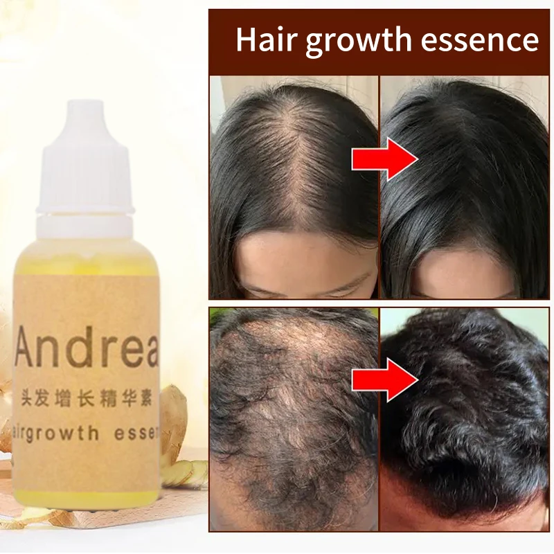 3/5 قطعة أندريا زيت نمو الشعر جوهر سماكة لنمو الشعر مصل تساقط الشعر المنتج 100% مستخلص نباتي طبيعي سائل 20 مللي #3