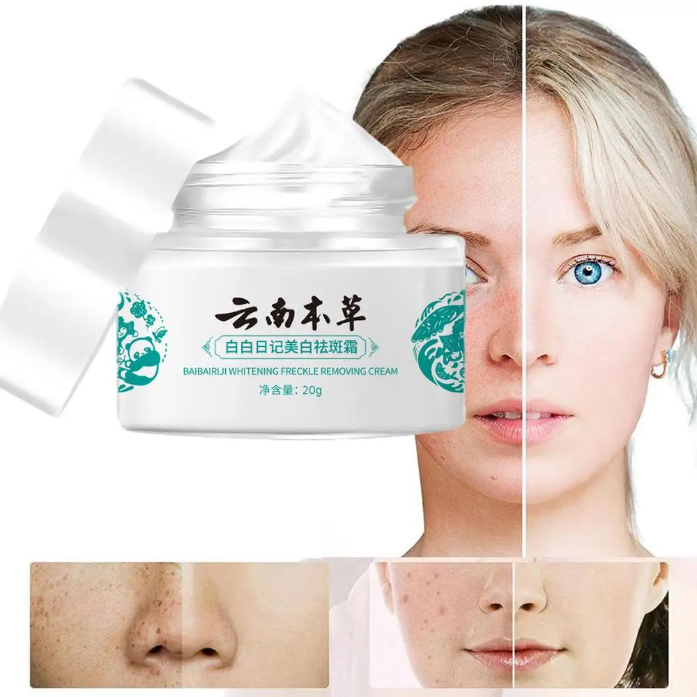 Yunnan Herbal Whitening Freckle Cream Effective Remove Skin Care Melasma Brighten Spots Cream Dark Remove Moisturize K1U4