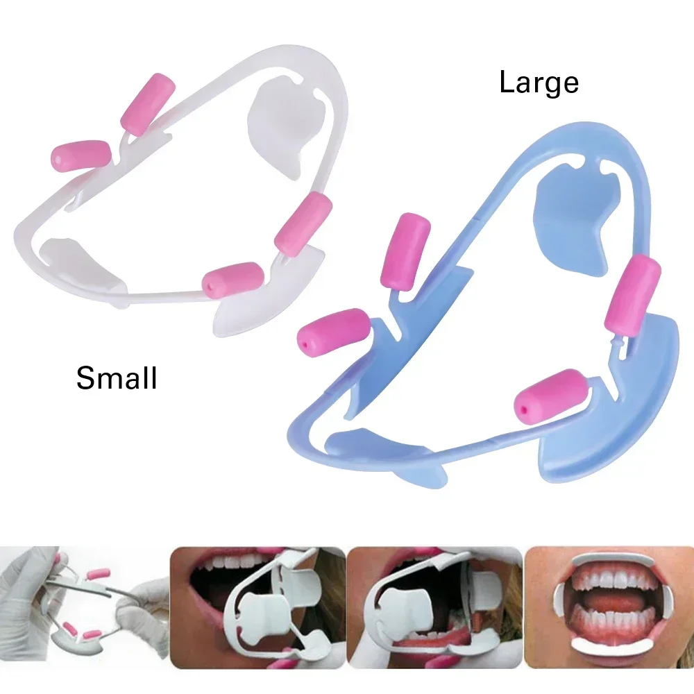 

Dental 3D Teeth Whitening Cheek Retractor O Shape Intraoral Cheek Lip Opener Orthodontic Teeth Mouth Opener Dentistry Tool