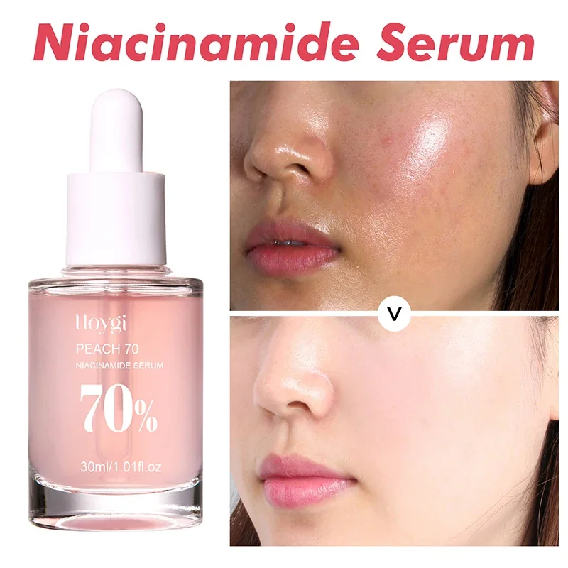 30 ml Pfirsich 70 % Niacinamid-Serum, feuchtigkeitsspendend, verhindert Trockenheit, ätherisches Gesichtsöl, steigert die Elastizität, glättet und macht die Haut