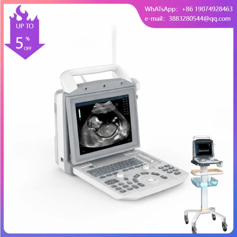Portable Vet Ultrasound Machine Diagnostic System Scanner Veterinary Ultrasound Machine For Hospital