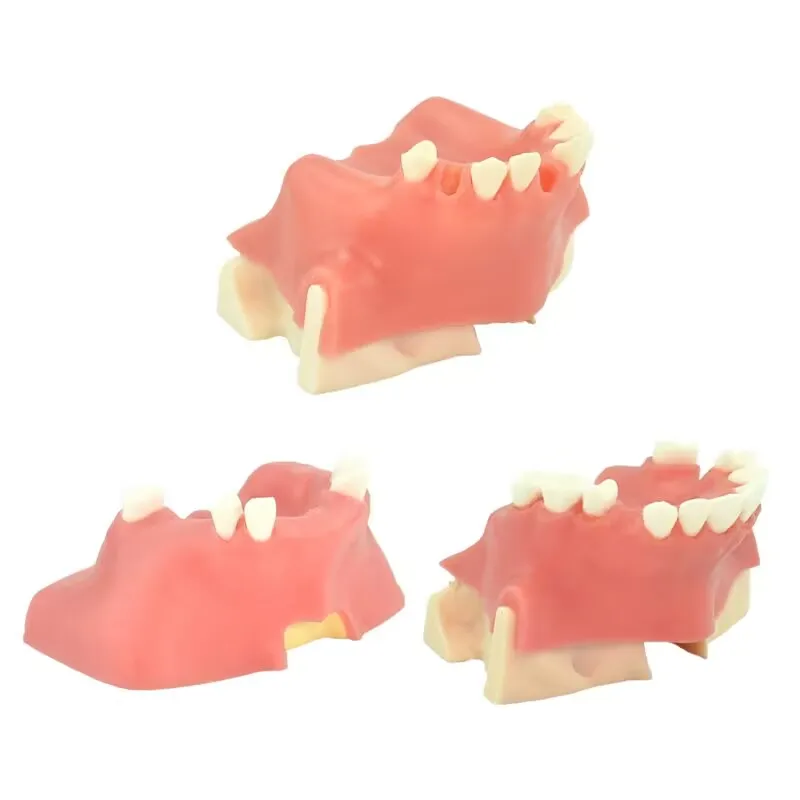 

Dental Maxillary Sinus Teeth Model Dentist Student Learning Model Dental Instrument Three Types