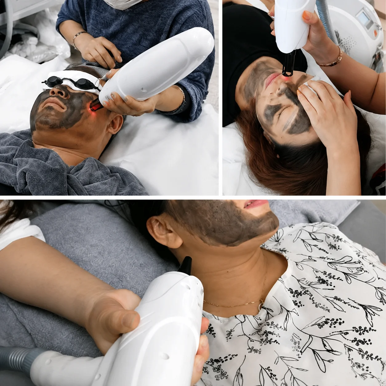300ml Soft Laser Carbon Cream gel for nd yag laser skin rejuvenation Whitening shrink pores
