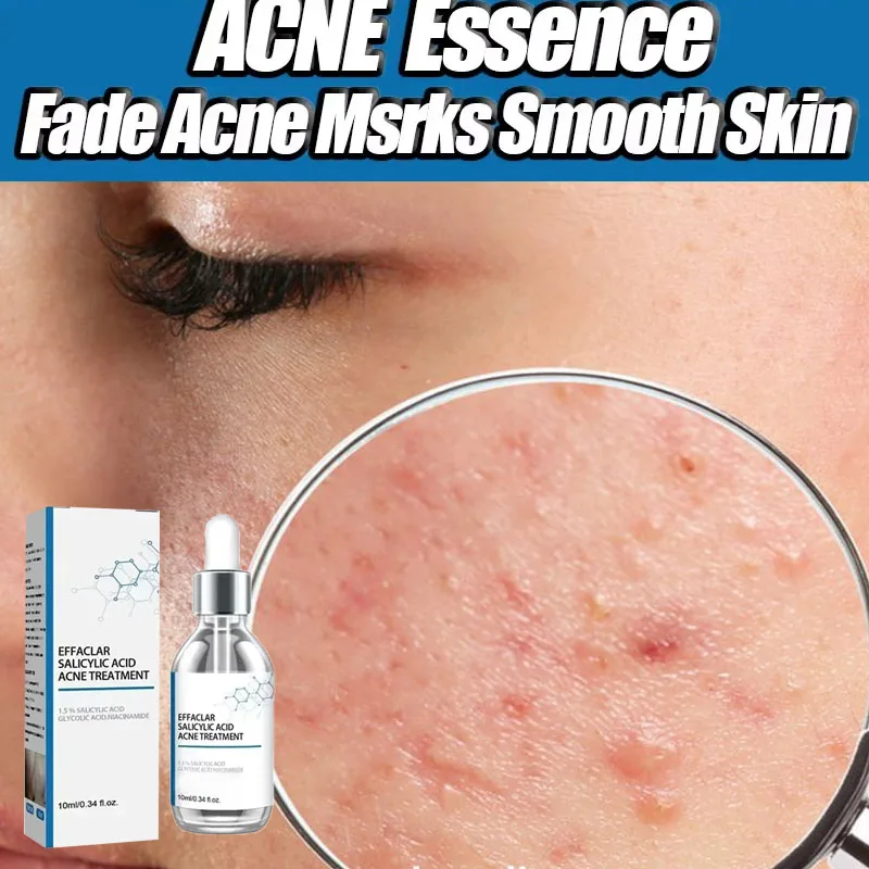 

Salicylic Acid Solution Essence Shrink pores and Acne Spot Removing Shrink Pores Oil-Control Brighten Face Skin Makeup