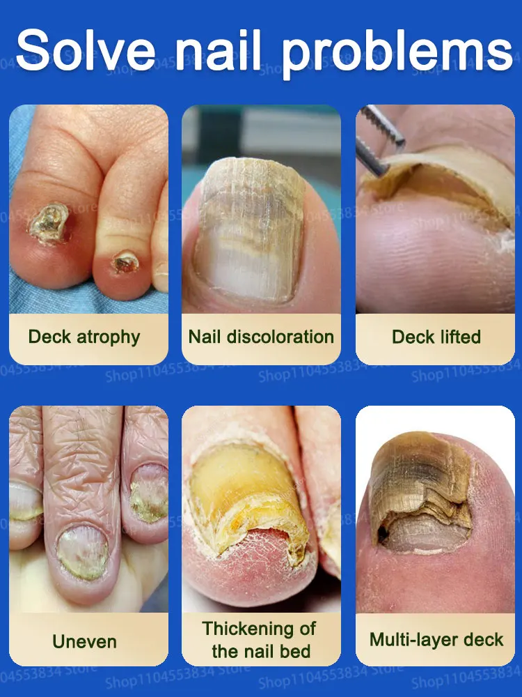 Apenas 5 dias Unhas Beleza Unha