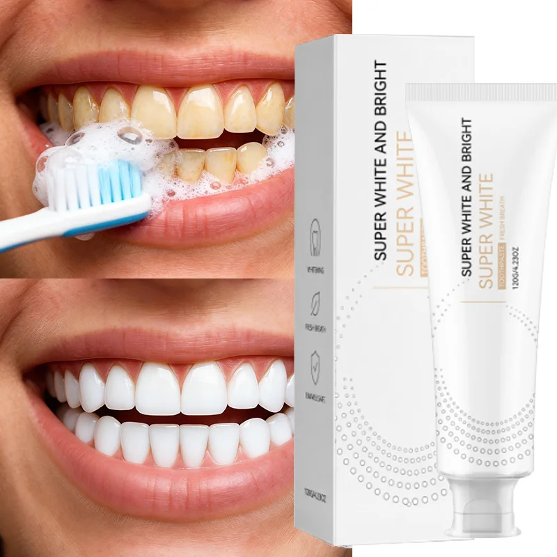 Bestselling Whitening Toothpaste: Say Goodbye to Yellow Teeth, Oral Hygiene Cleaning, and Teeth Care Tool