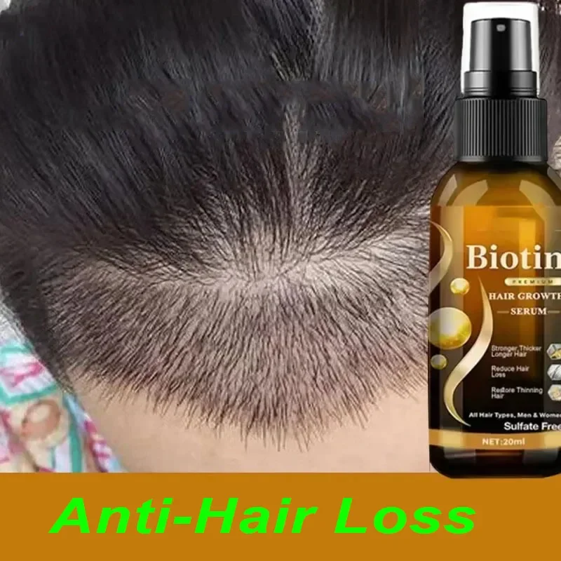 

Biotin Hair Spray for Man Women Repair Damage Restore Oil Scalp Repair Serum Spray Thicken Hair Health Care