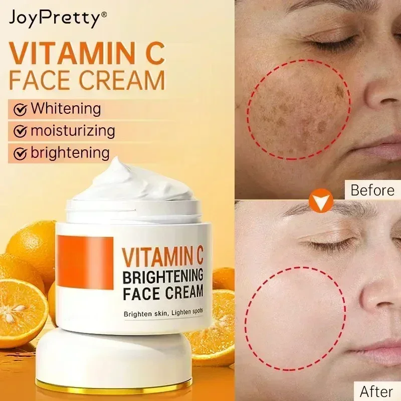 Pay the bill ``Fast Freckle Removal Serum Whitening Removes Chloasma Age Spots Hydrating Moisturizing Brightening Skin Care Faci