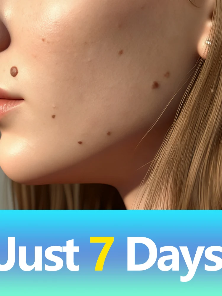 Fresco inicio Cuidado de la piel de invierno Resuelve tu problema