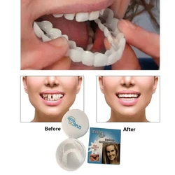 Dientes postizos de ajuste cómodo temporal superior e inferior, dentadura falsa, carillas de sonrisa, cubierta de soporte con Gel de pegamento de gutapercha