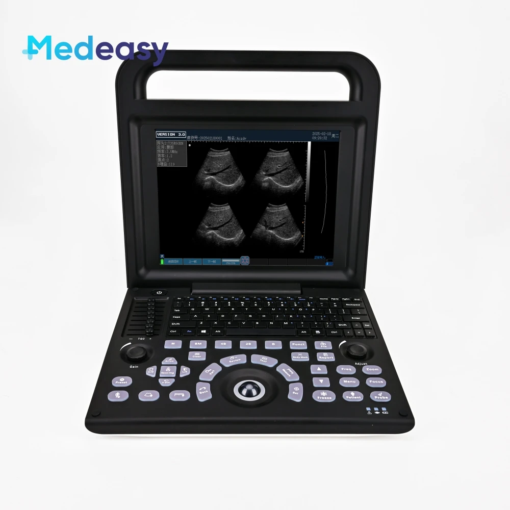 2026 Hot Selling Cheap Factory Price Medical Equipment 12 Inch Portable Human Body Machine Black and