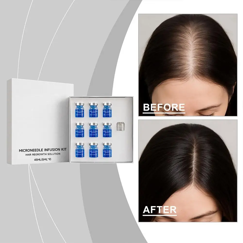 0.25mm Hair Essential Serum Micro-needle Roller Set Hair Follicle Nourishing Scalp Hair Care Hair Thicken Conditioner Essence